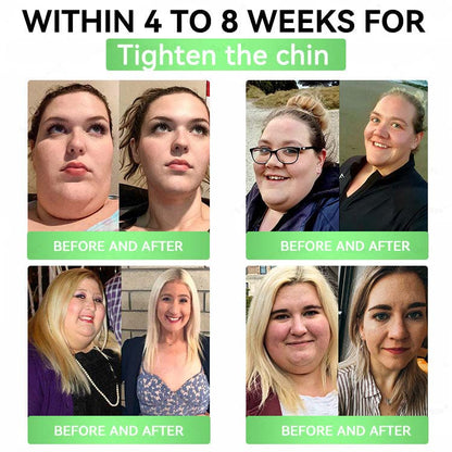 Alcuras® Moringa 8-Benefit Slimming & Metabolic Nano Microneedle changes in 7 days)  For obesity, Loose Skin,diabetes, sleep apnea, joint issues, and more