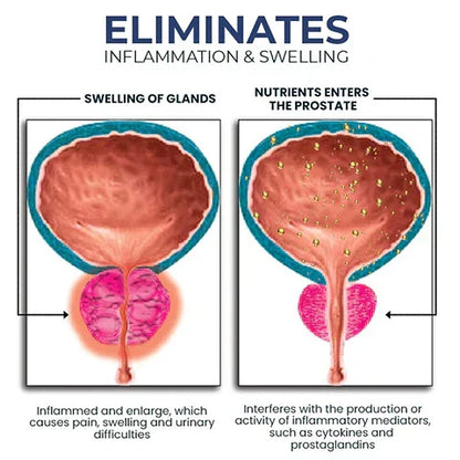Alcuras™ Nasal Inhaler for Prostate Health-Regain Your Confidence✨