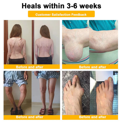 Alcuras™ Botulinum Toxin & Bee Venom Pain-Relief Bone Healing Cream🐝💎